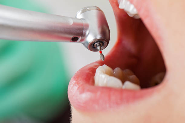 Best Emergency Cosmetic Dentistry (e.g., broken veneers) in Sharon, MS